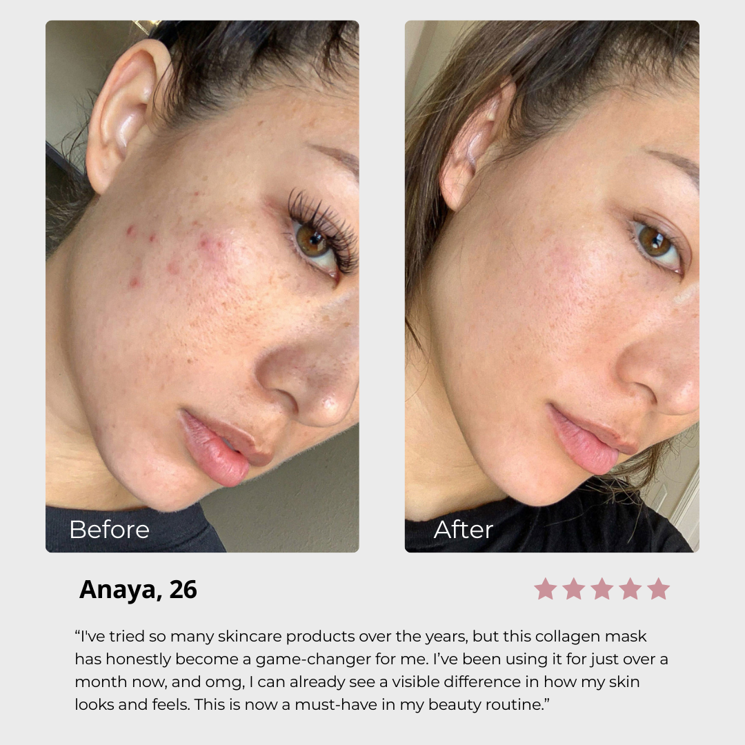 Collagen Face Mask
